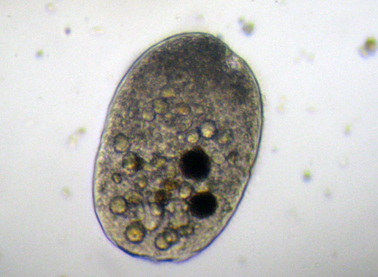 Tre Protozoi da identificare (se possibile)